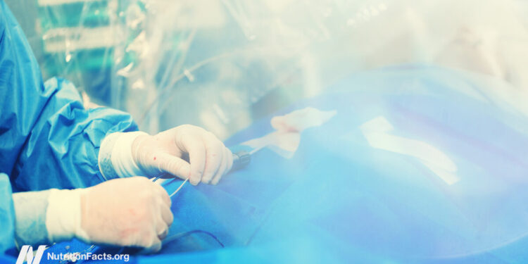 The Effectiveness of Angioplasty and Coronary heart Stent Procedures