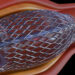 Coronary heart Stents and Their DangersÂ