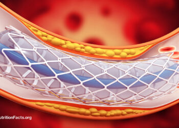 Why Use Stents When They Don’t Work? 
