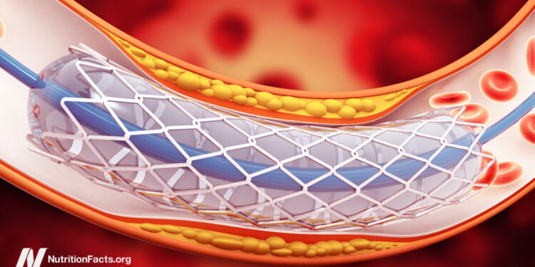 Why Use Stents When They Don’t Work?