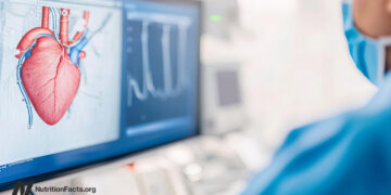 Cardiologists, Coronary heart Stents, and Upcoding 