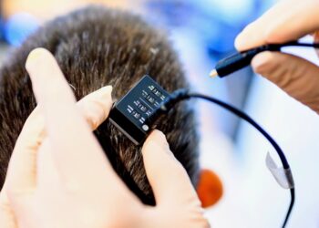 A Mind Implant Can Convert Ideas to Speech