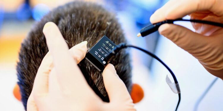 A Mind Implant Can Convert Ideas to Speech