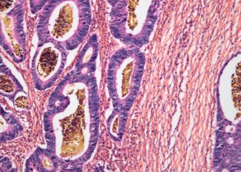 A New Immune Remedy Might Work In opposition to A number of Most cancers Sorts