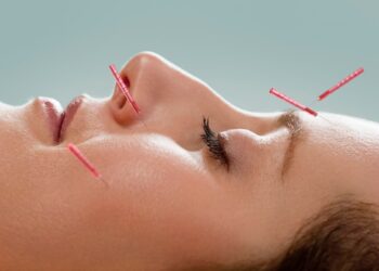 Is Facial Acupuncture the New Botox?