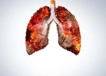 a burning challenge for the elf care group