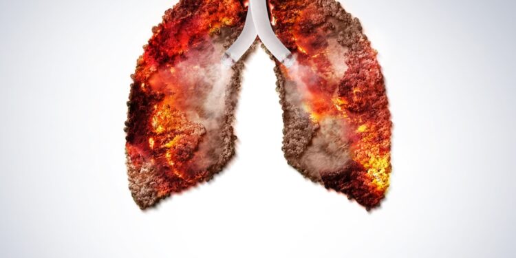 a burning challenge for the elf care group