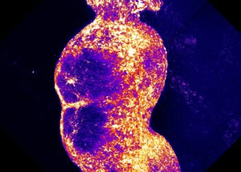 Ache pathway in a dish may assist seek for new analgesic medicine : Photographs