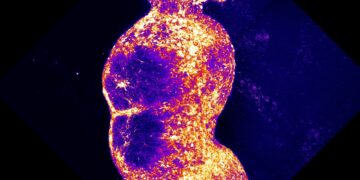 Ache pathway in a dish may assist seek for new analgesic medicine : Photographs