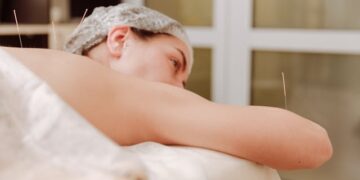 Prime 10 Advantages Of Acupuncture