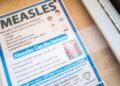 Measles math: What to learn about 1,001 measles instances throughout the nation : Photographs