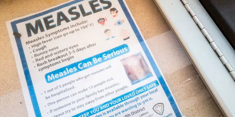 Measles math: What to learn about 1,001 measles instances throughout the nation : Photographs