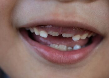 FDA strikes to ban fluoride dietary supplements for teenagers, eradicating a key instrument for dentists : Photographs