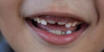 FDA strikes to ban fluoride dietary supplements for teenagers, eradicating a key instrument for dentists : Photographs