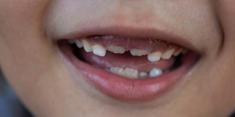 FDA strikes to ban fluoride dietary supplements for teenagers, eradicating a key instrument for dentists : Photographs