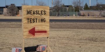 U.S. measles instances are the very best in 33 years, the CDC studies : Pictures