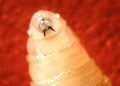A Uncommon Flesh-Consuming Screwworm Infects U.S. Resident