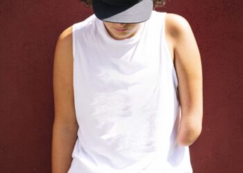 After an amputation, the mind remembers the physique’s misplaced limb : Photographs