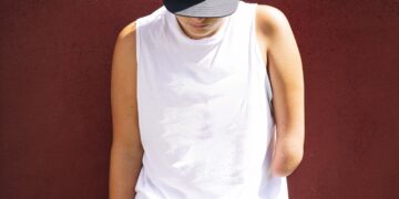 After an amputation, the mind remembers the physique’s misplaced limb : Photographs