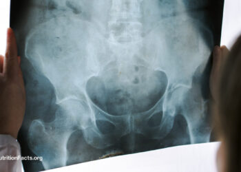 Pelvic Exams by Med College students on Anesthetized Ladies