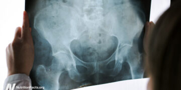 Pelvic Exams by Med College students on Anesthetized Ladies 