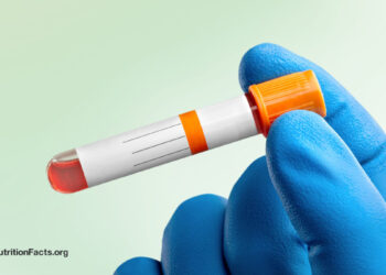 Superb vs. Regular Ldl cholesterol Ranges 