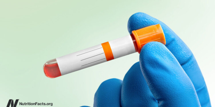 Superb vs. Regular Ldl cholesterol Ranges