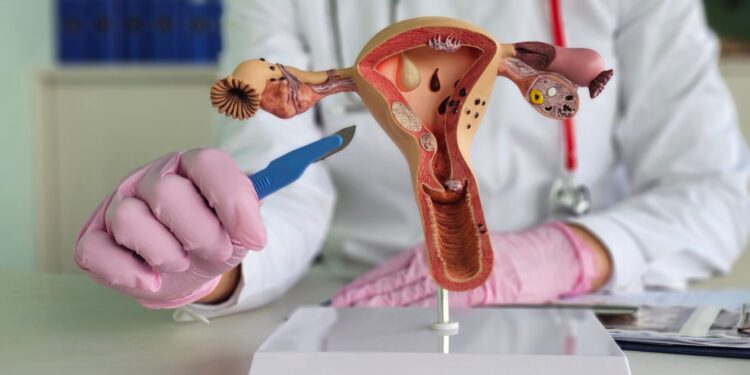 Recovering from Uterine Prolapse Surgical procedure: An Trustworthy, Unfiltered Account