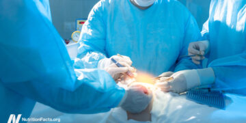 Bariatric Weight-Loss Surgical procedure and Mortality