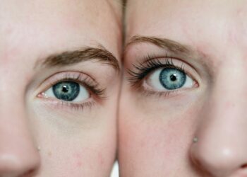 Physique dissatisfaction in adolescence: does it trigger consuming problems and melancholy later?