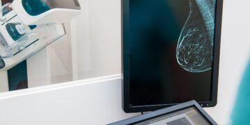 A New Research Challenges the Method We Display for Breast Most cancers