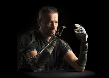 Amputees usually really feel disconnected from their bionic palms. AI may bridge the hole : Pictures