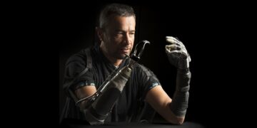 Amputees usually really feel disconnected from their bionic palms. AI may bridge the hole : Pictures