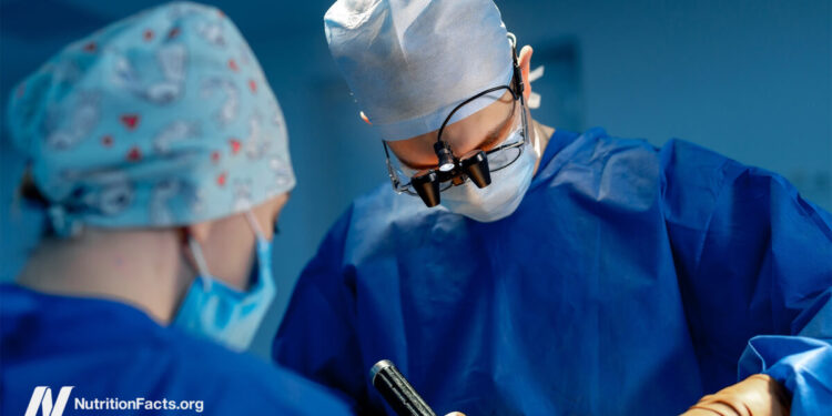 Bariatric Surgical procedure: Dangers within the OR and Past