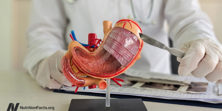 The Hidden Prices of Bariatric Surgical procedure