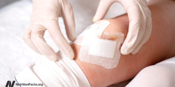 When the Repair Is an Phantasm