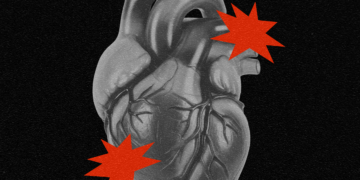 The New Technique to Predict Your Threat of a Coronary heart Assault