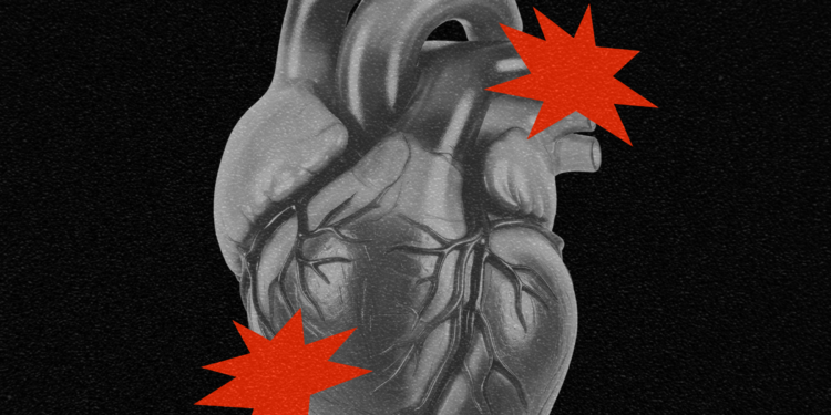 The New Technique to Predict Your Threat of a Coronary heart Assault