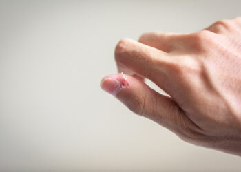 Pores and skin-picking as self-soothing: is emotion regulation the lacking piece?