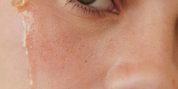 Is the Longevity Motion Headed for a Backlash?