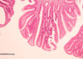 Might Bovine Leukemia Virus be a Explanation for Breast Most cancers?