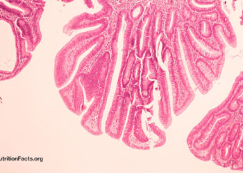 Might Bovine Leukemia Virus be a Explanation for Breast Most cancers?