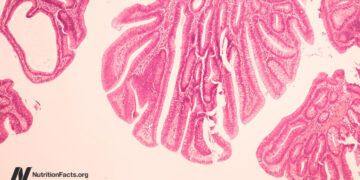 Might Bovine Leukemia Virus be a Explanation for Breast Most cancers?