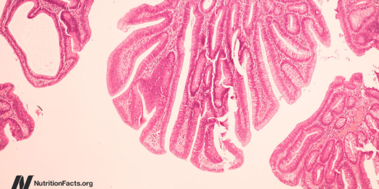 Might Bovine Leukemia Virus be a Explanation for Breast Most cancers?