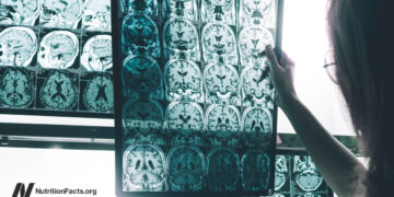 A Persistent Pesticide Is Linked to Alzheimer’s Threat