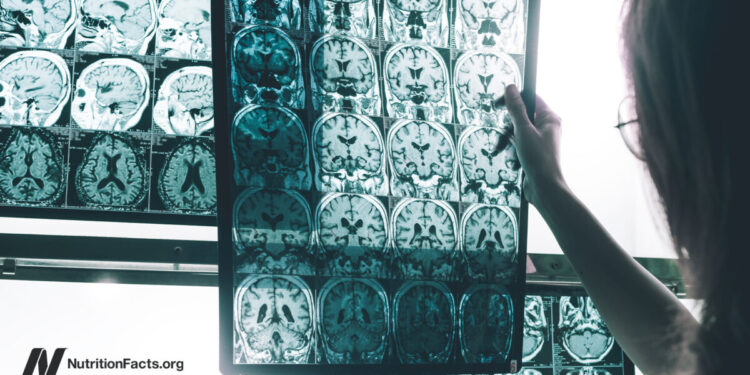 A Persistent Pesticide Is Linked to Alzheimer’s Threat