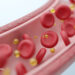 How a Single Meal Can Cripple Your Arteries and Lungs