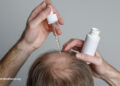 The Advantages and Dangers of Hair Loss Medicine