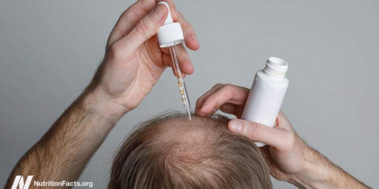 The Advantages and Dangers of Hair Loss Medicine