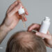 The Advantages and Dangers of Hair Loss Medicine